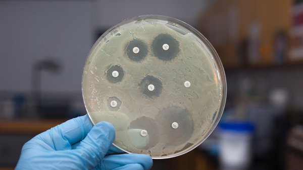 España es el país europeo con mayor reducción en el uso de antibióticos en animales según la OCV