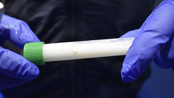 Vacuna contra mastitis: prevención eficaz y económica